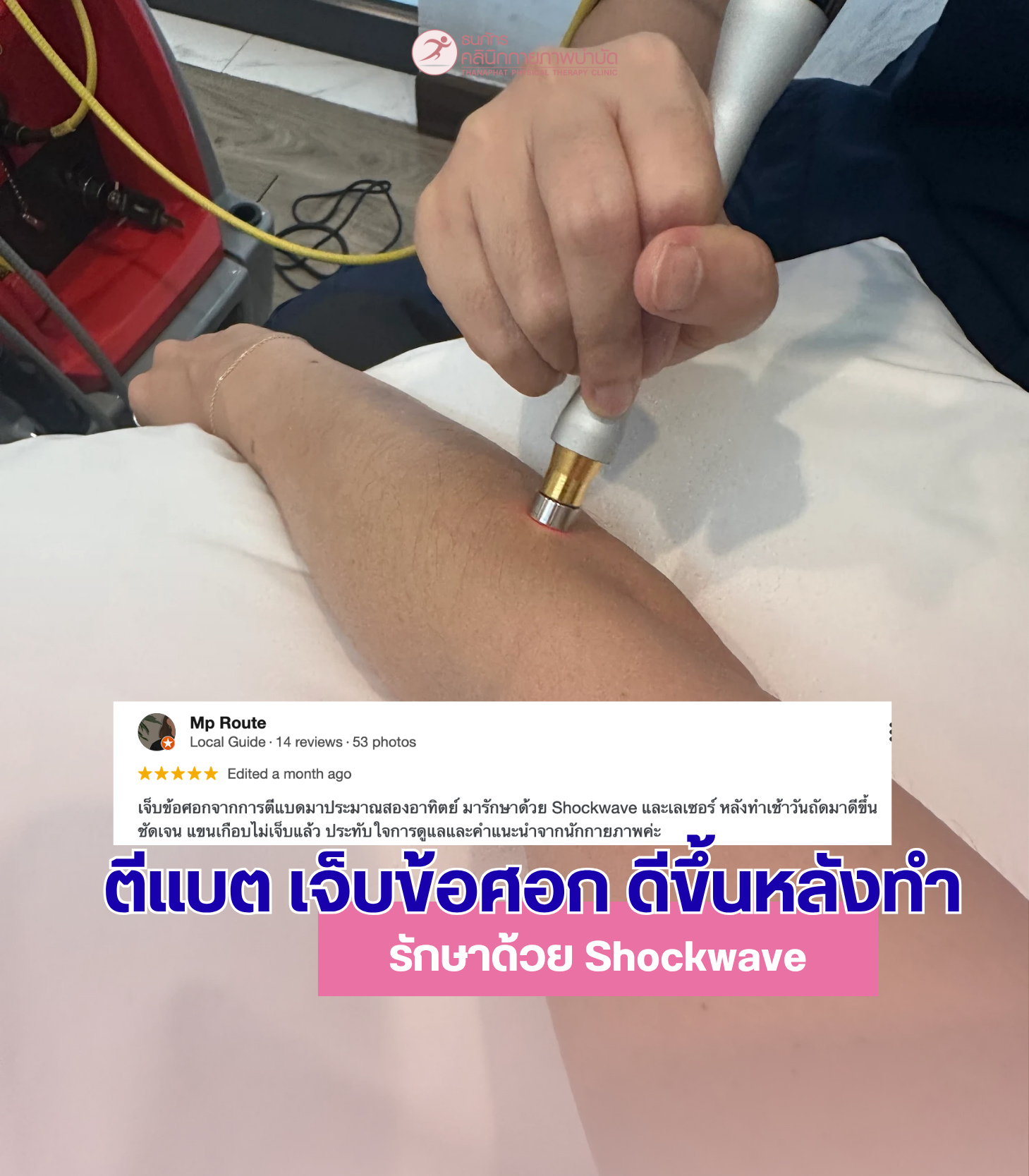 ธนภัทรคลินิก-รีวิว Review บาดเจ็บจากอุบัติเหตุ ปวดข้อศอก ตีแบต รักษาด้วย scockwave laser